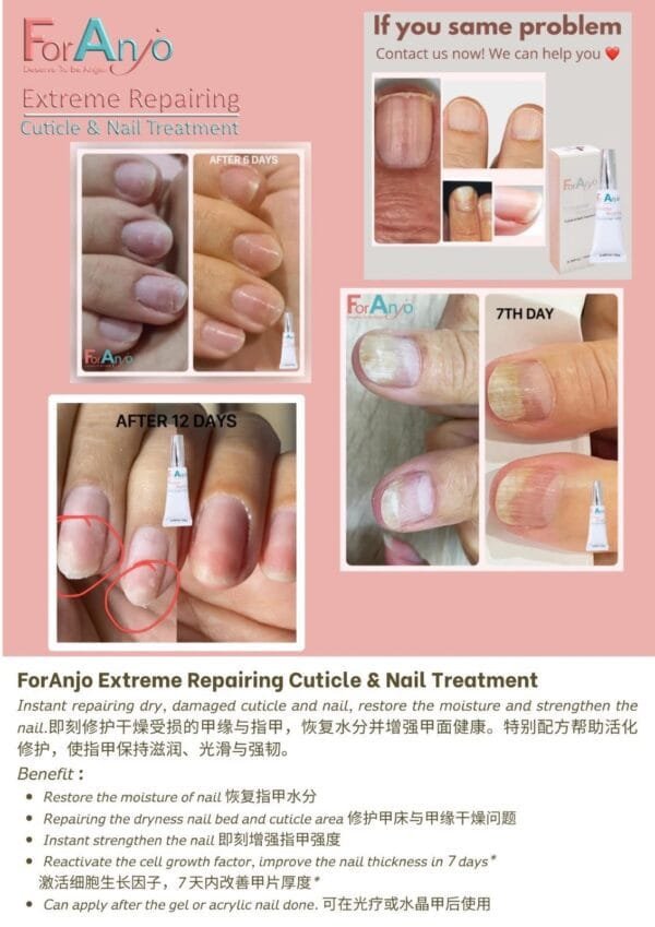 Cuticle & Nail Treatment 10g - Image 2