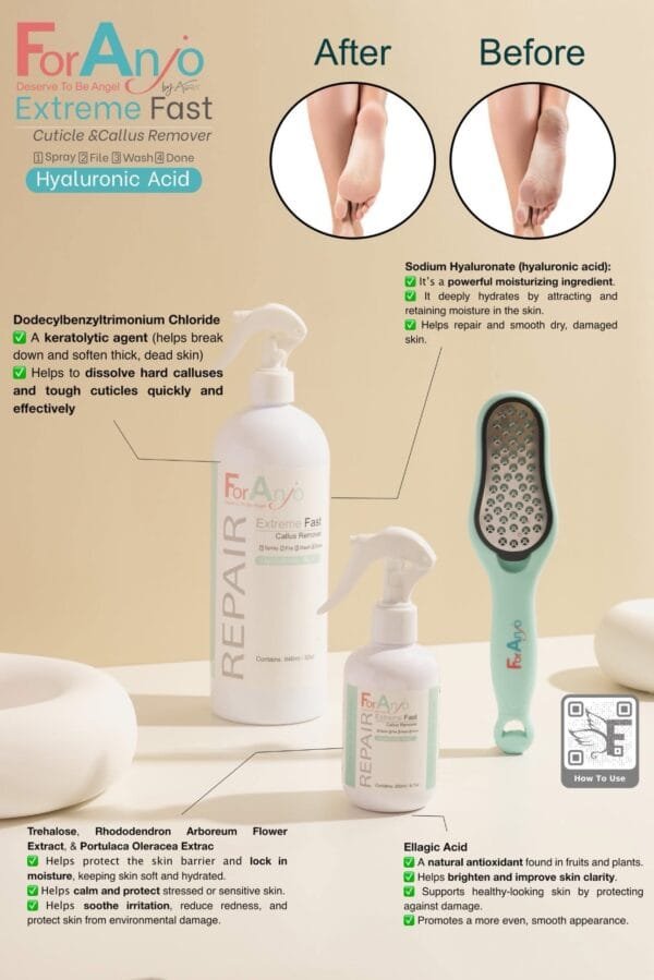 4Anjo Callus Remover